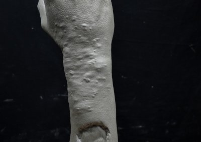 Prototipos de simulador médico