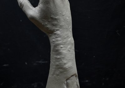 Prototipos de simulador médico