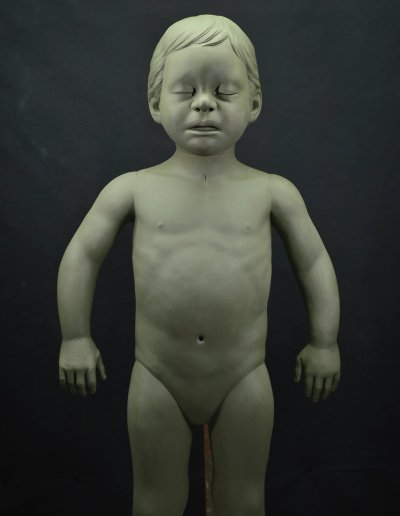Prototipos de simulador médico
