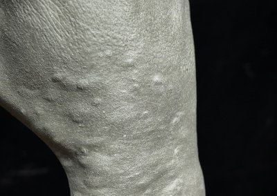 Prototipos de simulador médico